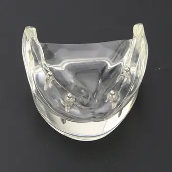 1Pc 4 Dantų Implantų Dantų Studijų Modelį Overdenture Prastesnės Demo Modelis